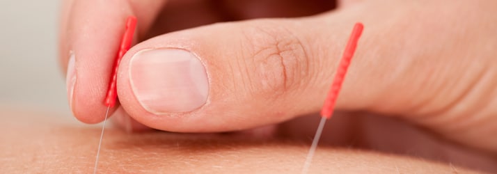 page-acupuncture3 acupuncture
